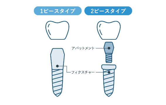 クリア歯科は2ピースタイプのインプラントを使用