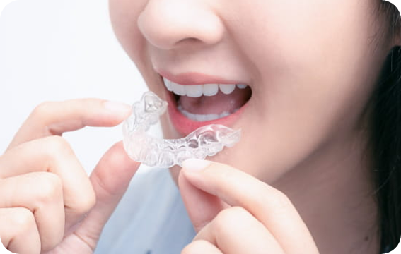   マウスピース矯正（例：インビザライン、クリアコレクト）
